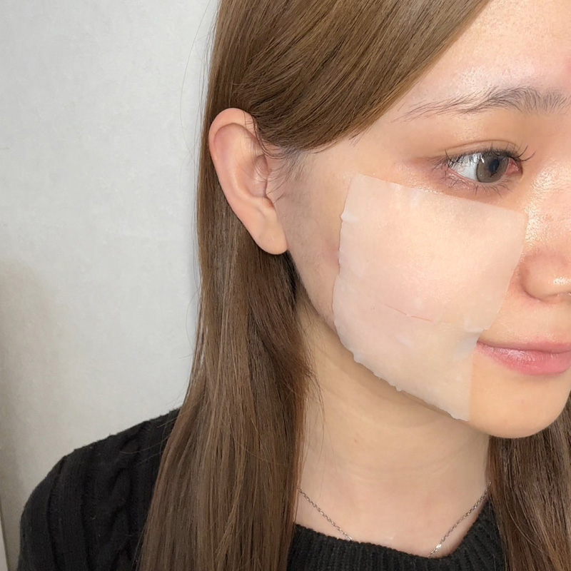 Quality 1st Derma Laser Shot X Super Teatree100 + CICA. Маска на основе центеллы азиатской и масла чайного дерева 100 для проблемной и чувствительной кожи лица Кволити Фест дерма лазер, 15 шт.